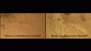 Heart-contrast-agent