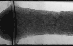 This 1.5 mm-wide microscope image shows human heart cells growing around a polymer strand (at left). The cells pulse in unison, just as they would in a real heart. (Image: Yimu Zhao)