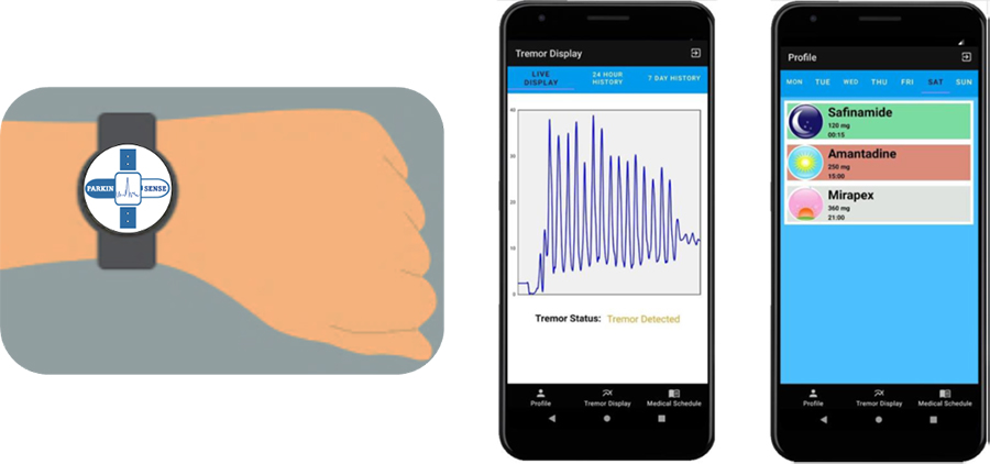 ParkinSense is a medical monitoring system that uses wearables to provide detailed, real-time data on the symptoms of Parkinson’s disease. It can be used to objectively determine the effectiveness of treatment. (Image courtesy: ParkinSense)