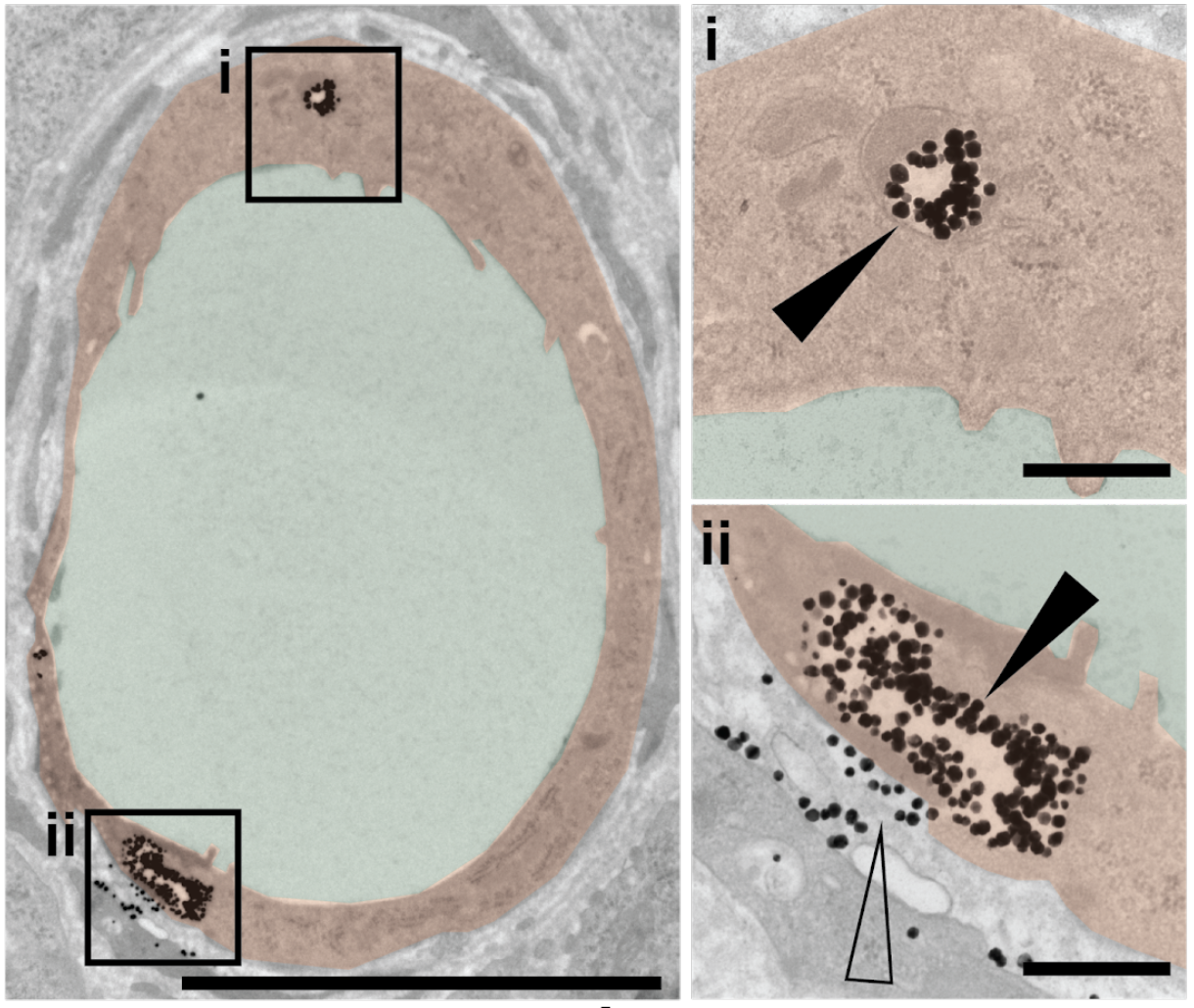 A transmission emission microscopy image of the endothelial cells surrounding blood vessels. The solid arrows indicate that the nanoparticles (dark spots) are engulfed by the endothelial cells instead of passing through gaps between the cells. (Image: Shrey Sindhwani)