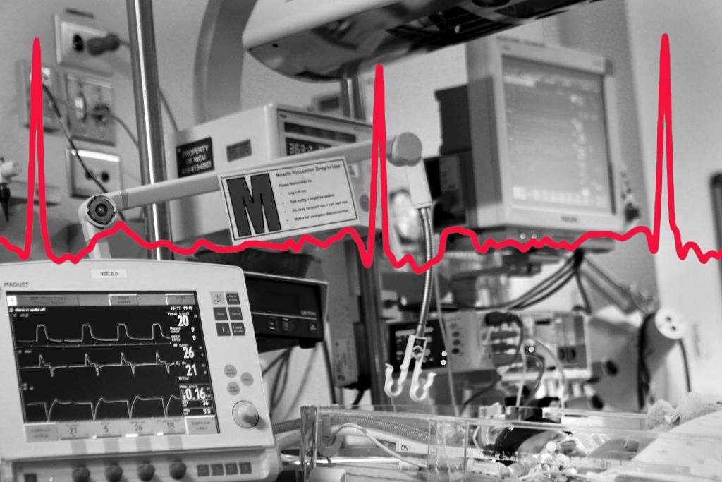 Composite image of an ECG readout over image from pediatric ICU at SickKids. (Courtesy Laussen Labs)